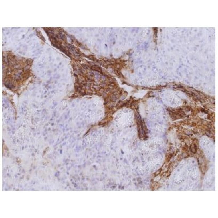 IHC - Anti-Carcino Embryonic Antigen CEA Antibody [CB30] (A86638)