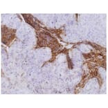 IHC - Anti-Carcino Embryonic Antigen CEA Antibody [CB30] (A86638)