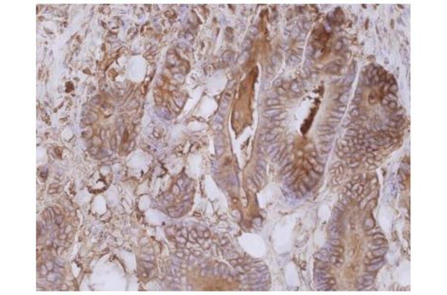 IHC - Anti-Carcino Embryonic Antigen CEA Antibody [CB30] (A86638)