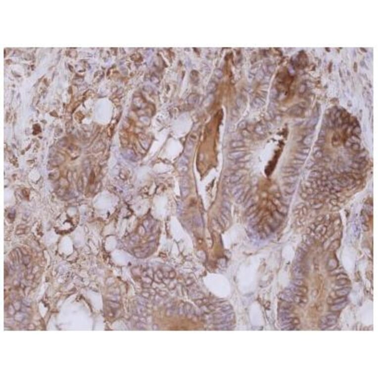 IHC - Anti-Carcino Embryonic Antigen CEA Antibody [CB30] (A86638)