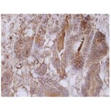 IHC - Anti-Carcino Embryonic Antigen CEA Antibody [CB30] (A86638)