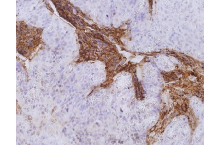 Immunohistochemistry - Anti-Carcinoembryonic Antigen Antibody [CB30] (A86637) - Antibodies.com