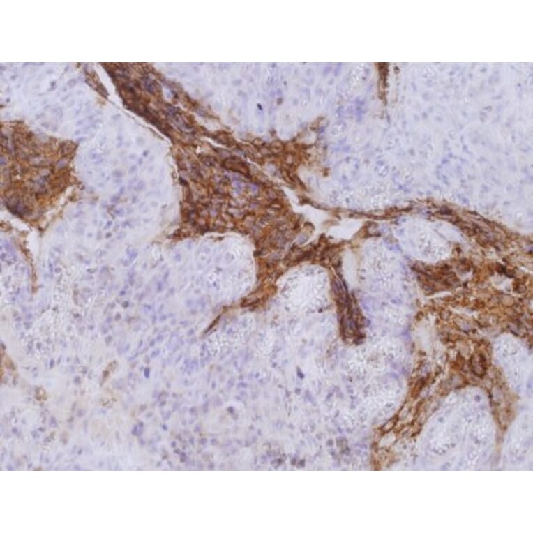 Immunohistochemistry - Anti-Carcinoembryonic Antigen Antibody [CB30] (A86637) - Antibodies.com