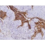 Immunohistochemistry - Anti-Carcinoembryonic Antigen Antibody [CB30] (A86637) - Antibodies.com