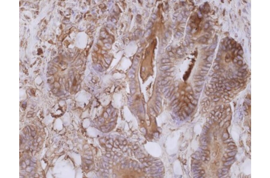 Immunohistochemistry - Anti-Carcinoembryonic Antigen Antibody [CB30] (A86638) - Antibodies.com