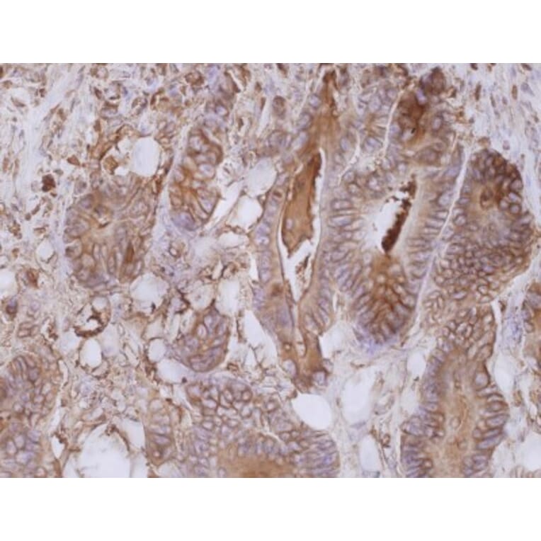 Immunohistochemistry - Anti-Carcinoembryonic Antigen Antibody [CB30] (A86638) - Antibodies.com