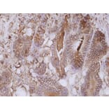 Immunohistochemistry - Anti-Carcinoembryonic Antigen Antibody [CB30] (A86638) - Antibodies.com