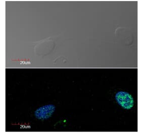 ICC - Anti-Ki67 Antibody [Ki-67] (A86644)