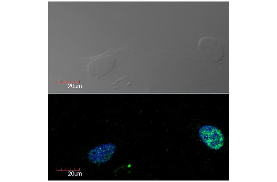 ICC - Anti-Ki67 Antibody [Ki-67] (A86644)