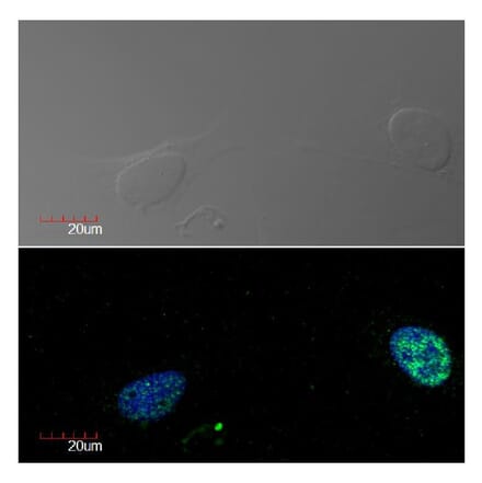 ICC - Anti-Ki67 Antibody [Ki-67] (A86644)