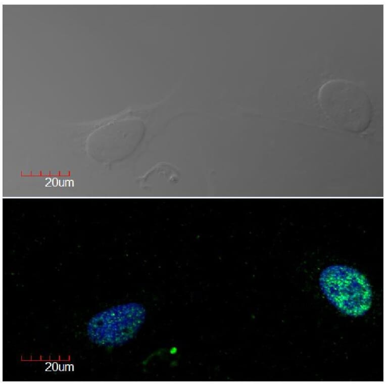 ICC - Anti-Ki67 Antibody [Ki-67] (A86644)