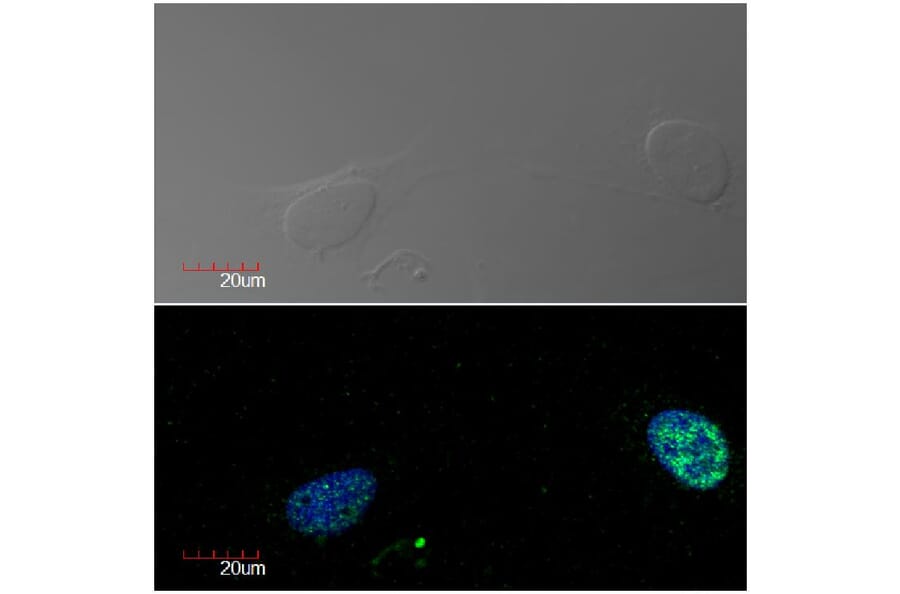 Immunocytochemistry - Anti-Ki67 Antibody [Ki-67] (A86642) - Antibodies.com
