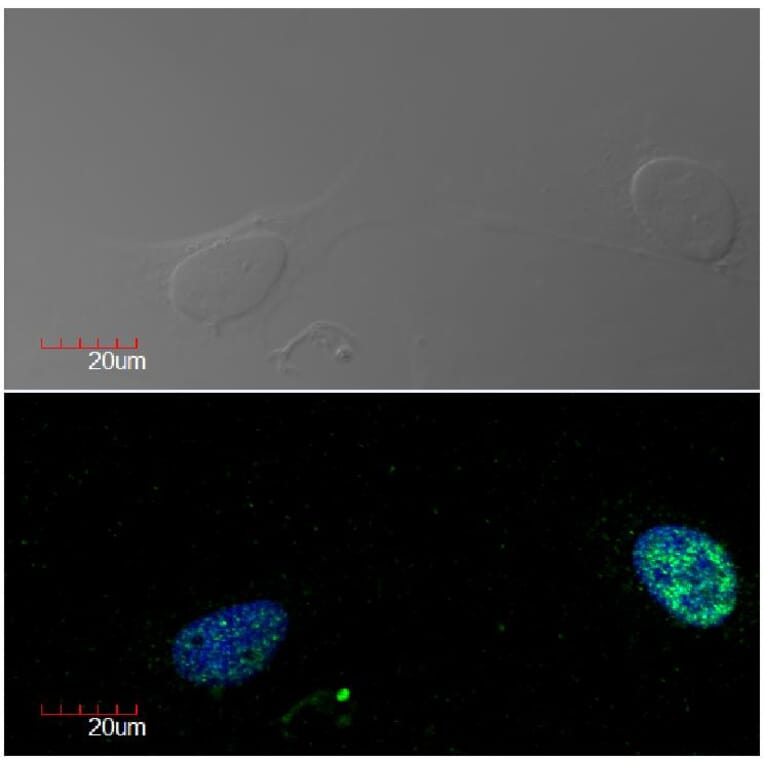 Immunocytochemistry - Anti-Ki67 Antibody [Ki-67] (A86642) - Antibodies.com