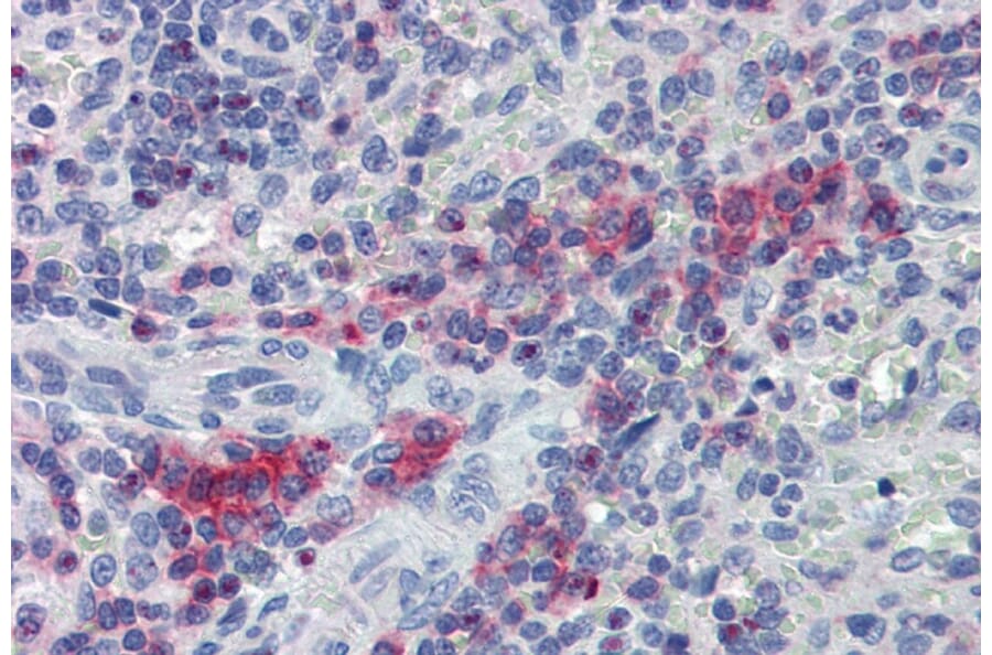 Immunohistochemistry - Anti-LIME Antibody (A86644) - Antibodies.com