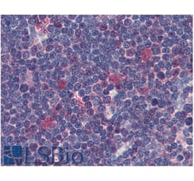 IHC - Anti-CDK1 Antibody [POH-1] (A86650)
