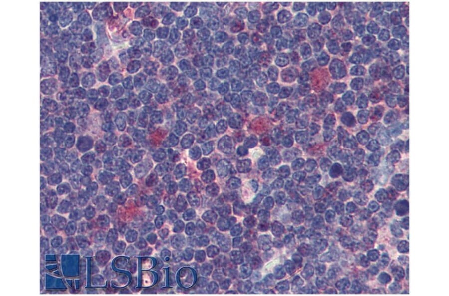 IHC - Anti-CDK1 Antibody [POH-1] (A86650)