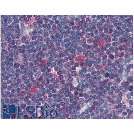 IHC - Anti-CDK1 Antibody [POH-1] (A86650)