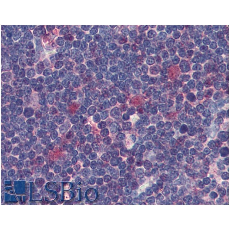 IHC - Anti-CDK1 Antibody [POH-1] (A86650)