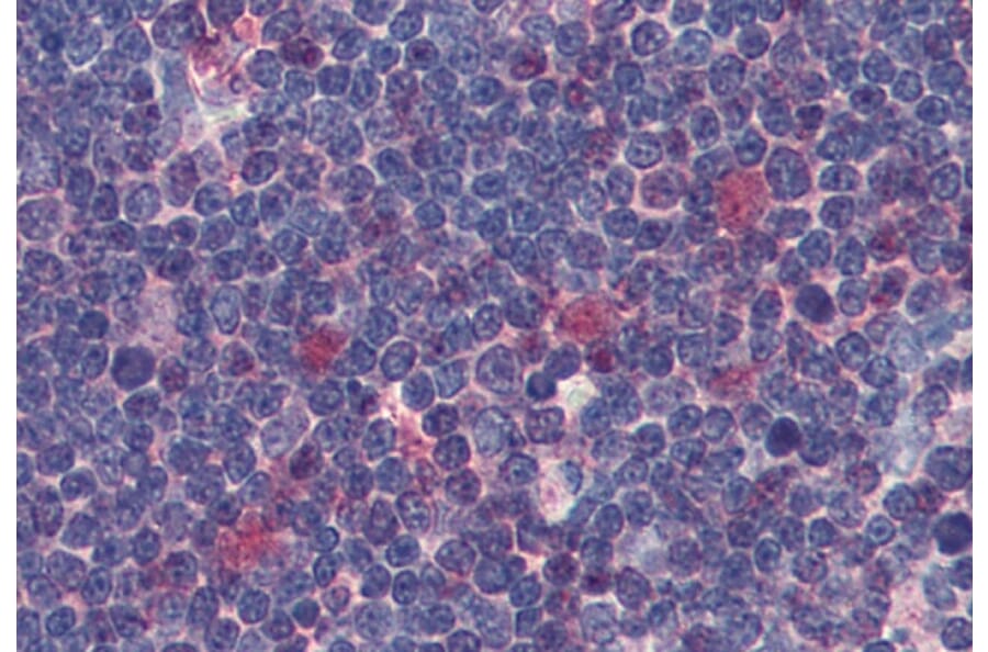 Immunohistochemistry - Anti-CDK1 Antibody [POH-1] (A86649) - Antibodies.com