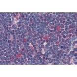 Immunohistochemistry - Anti-CDK1 Antibody [POH-1] (A86649) - Antibodies.com