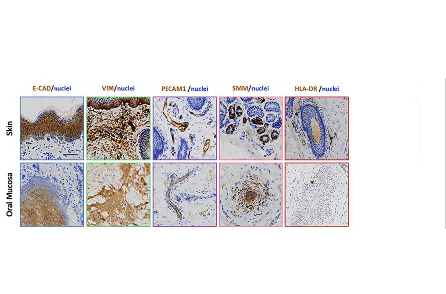Immunohistochemistry - Anti-Vimentin Antibody [VI-10] - Antibodies.com