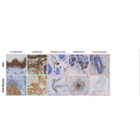 Immunohistochemistry - Anti-Vimentin Antibody [VI-10] - Antibodies.com