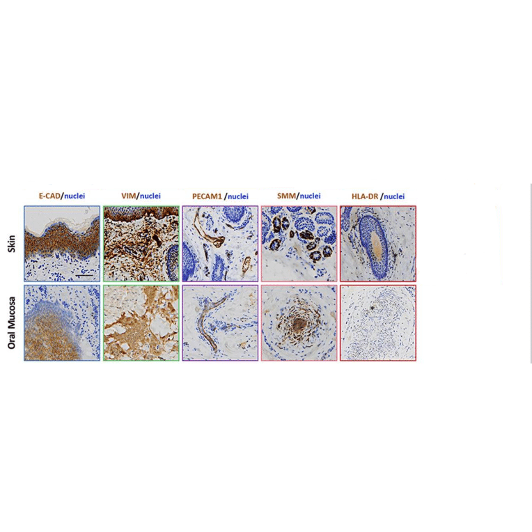 Immunohistochemistry - Anti-Vimentin Antibody [VI-10] - Antibodies.com