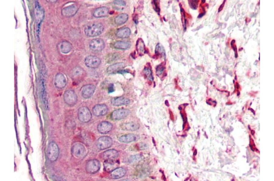 IHC - Anti-Vimentin Antibody [VI-10] (A86652)