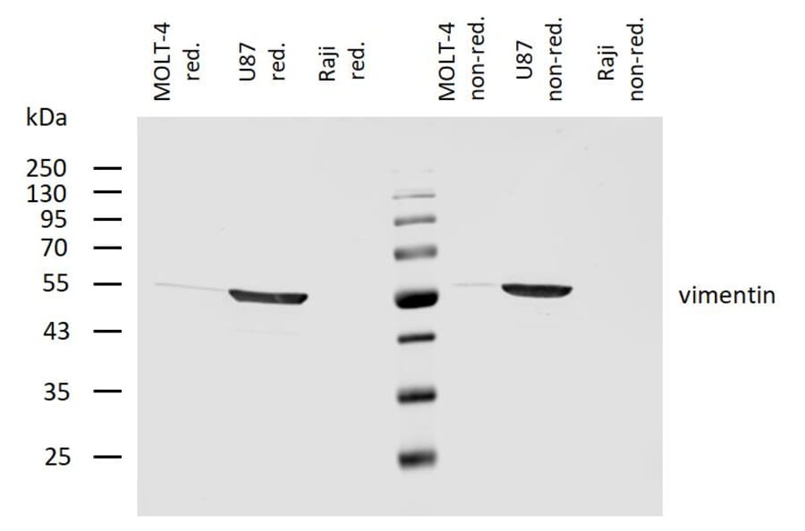WB - Anti-Vimentin Antibody [VI-10] (A86652)