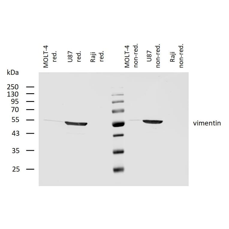 WB - Anti-Vimentin Antibody [VI-10] (A86652)