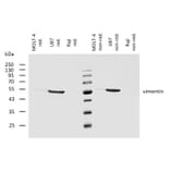 WB - Anti-Vimentin Antibody [VI-10] (A86652)