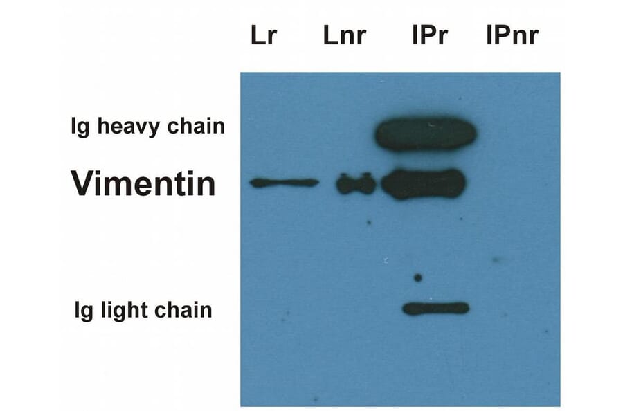 IP - Anti-Vimentin Antibody [VI-10] (A86652)