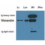 IP - Anti-Vimentin Antibody [VI-10] (A86652)