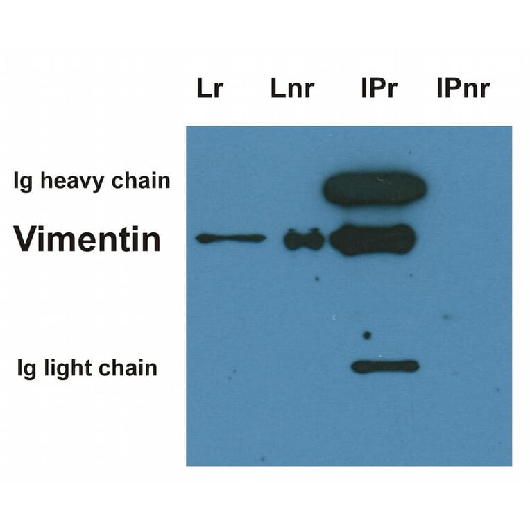 Immunoprecipitation - Anti-Vimentin Antibody [VI-10] (A86652) - Antibodies.com