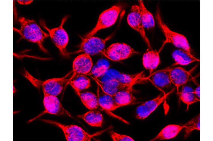 Immunocytochemistry - Anti-Vimentin Antibody [VI-10] (A86652) - Antibodies.com
