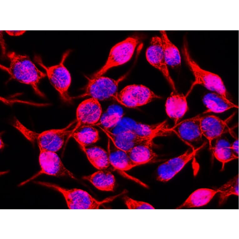 Immunocytochemistry - Anti-Vimentin Antibody [VI-10] (A86652) - Antibodies.com