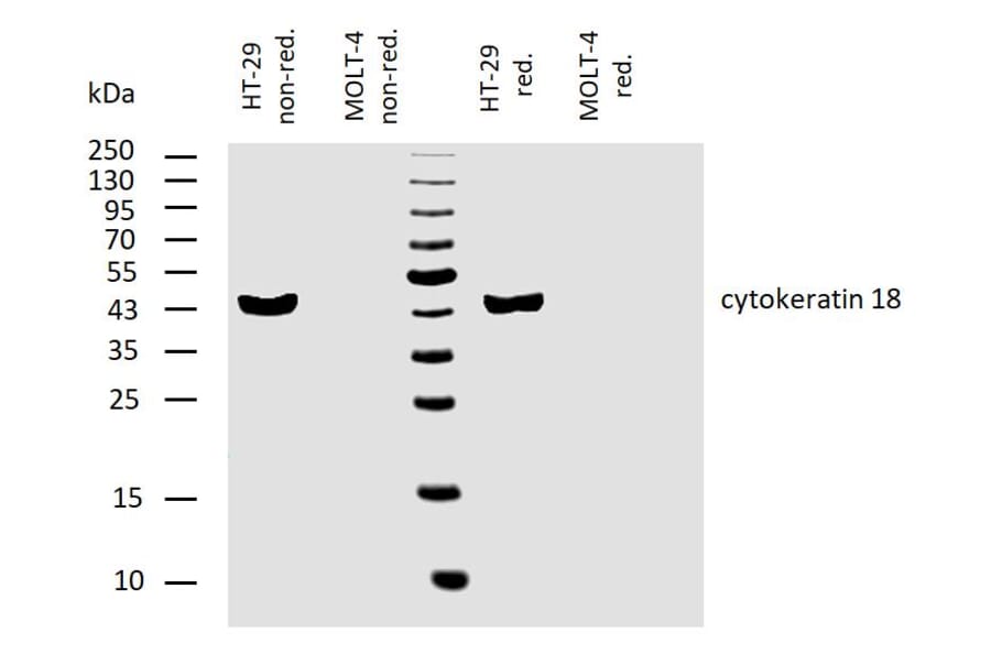WB - Anti-Cytokeratin 18 Antibody [C-04] (A86656)