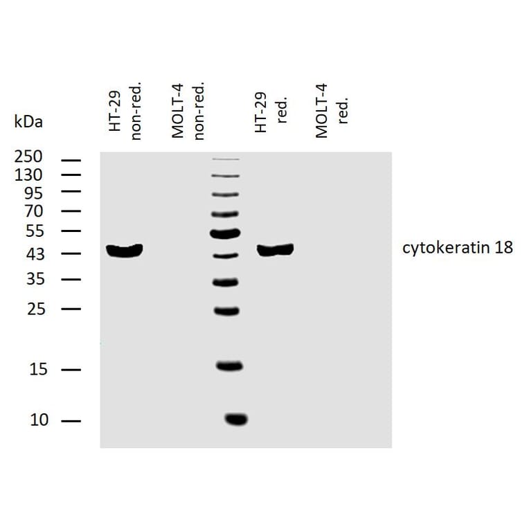 WB - Anti-Cytokeratin 18 Antibody [C-04] (A86656)
