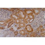 Immunohistochemistry - Anti-Cytokeratin 18 Antibody [C-04] (A86656) - Antibodies.com