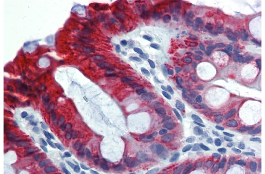 Immunohistochemistry - Anti-Cytokeratin 18 Antibody [C-04] (A86655) - Antibodies.com