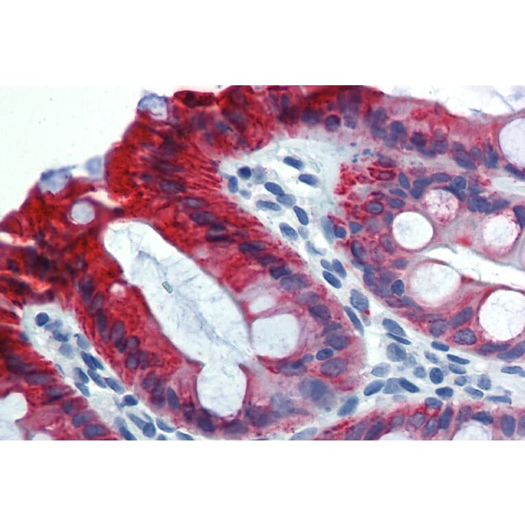 Immunohistochemistry - Anti-Cytokeratin 18 Antibody [C-04] (A86655) - Antibodies.com