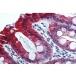 Immunohistochemistry - Anti-Cytokeratin 18 Antibody [C-04] (A86655) - Antibodies.com