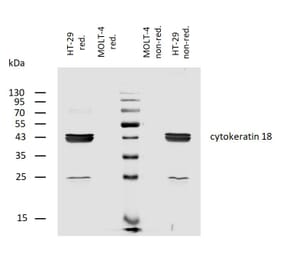 WB - Anti-Cytokeratin 18 Antibody [C-04] (Biotin) (A86659)