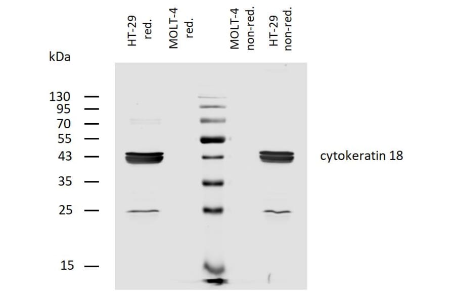 WB - Anti-Cytokeratin 18 Antibody [C-04] (Biotin) (A86659)