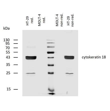 WB - Anti-Cytokeratin 18 Antibody [C-04] (Biotin) (A86659)