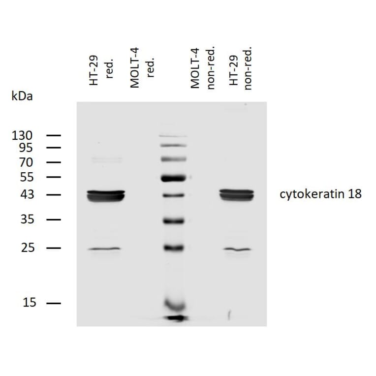 WB - Anti-Cytokeratin 18 Antibody [C-04] (Biotin) (A86659)