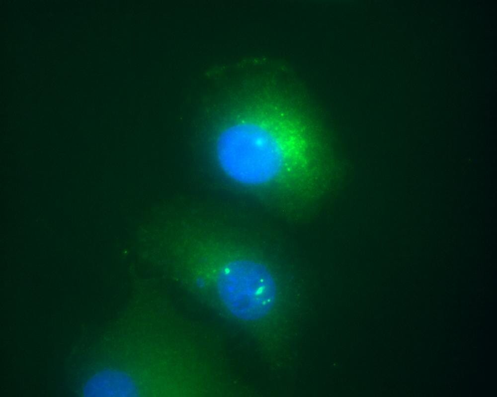 Immunofluorescence staining of Daxx in transfected HeLa human cervix carcinoma cell line. Myc Daxx (green) was stained with Anti-Daxx Antibody (A86665), nuclei were stained with DAPI (blue). Nuclear localization of Daxx in HeLa cells transfected with pCDNA3-MycDaxx.