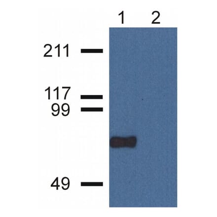 WB - Anti-CPNE7 Antibody [CPNE7-01] (A86676)