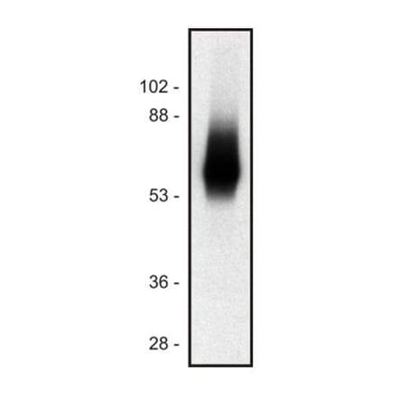 Western Blot - Anti-TRIM Antibody [TRIM-04] (A86680) - Antibodies.com