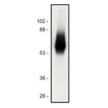 Western Blot - Anti-TRIM Antibody [TRIM-04] (A86680) - Antibodies.com